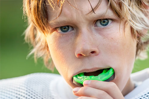 Save Your Smile With Sports Mouthguards